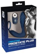 You2Toys Prostata model analny z pilotem 10 trybow wibracji czarny You2Toys