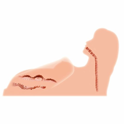 Hera 3 model anatomiczny z trzema kanałami TPR 3D